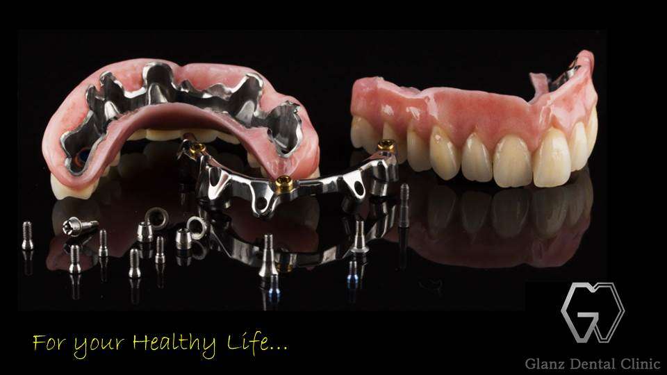 流山のグランツ歯科クリニックでは「All on 4」「All on 6」など、「オールオン- X-」のインプラント治療が受けられます。