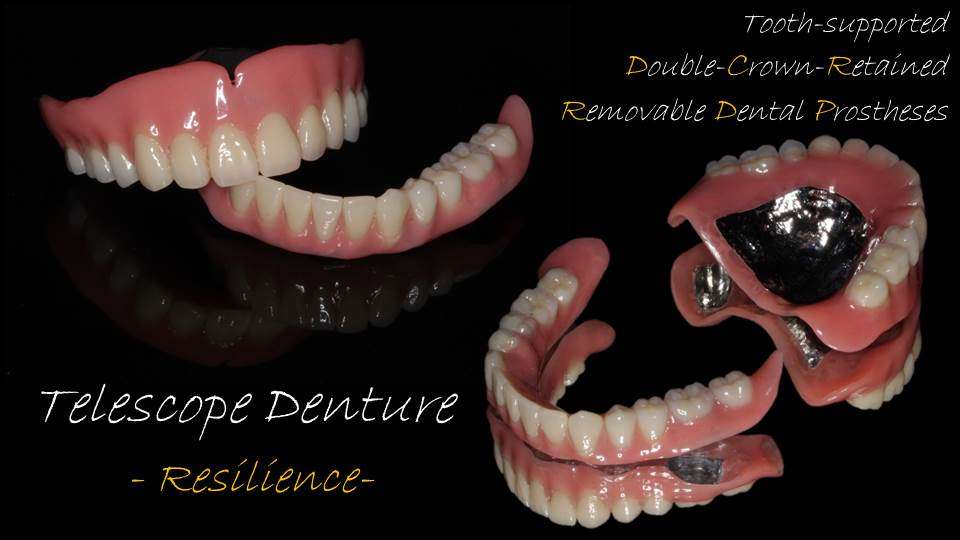 流山のグランツ歯科クリニックで「よく咬めて違和感が少なくて見た目が良い」テレスコープ義歯の治療を受けませんか？